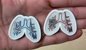 Lungs X-Ray Markers